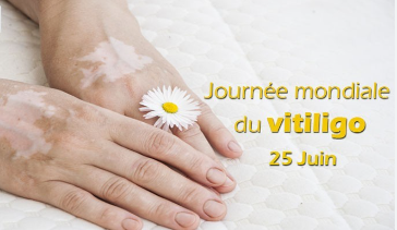 Today, World Vitiligo Day: The reasons for an international initiative