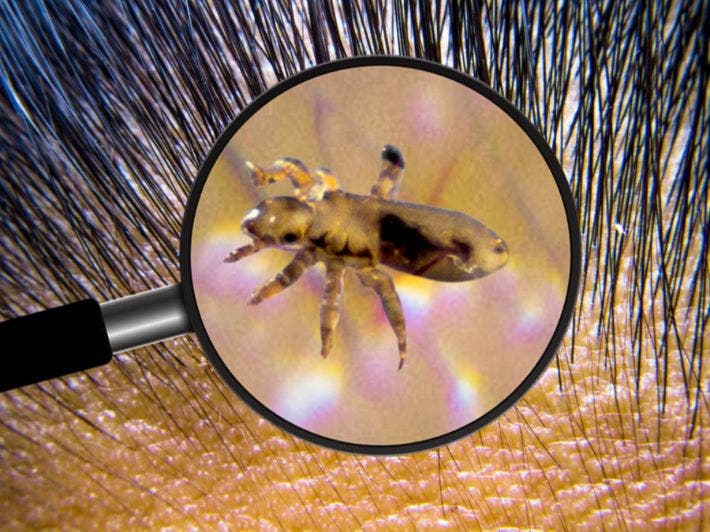 Mite: “Lice and nits” creep into the heads of schoolchildren