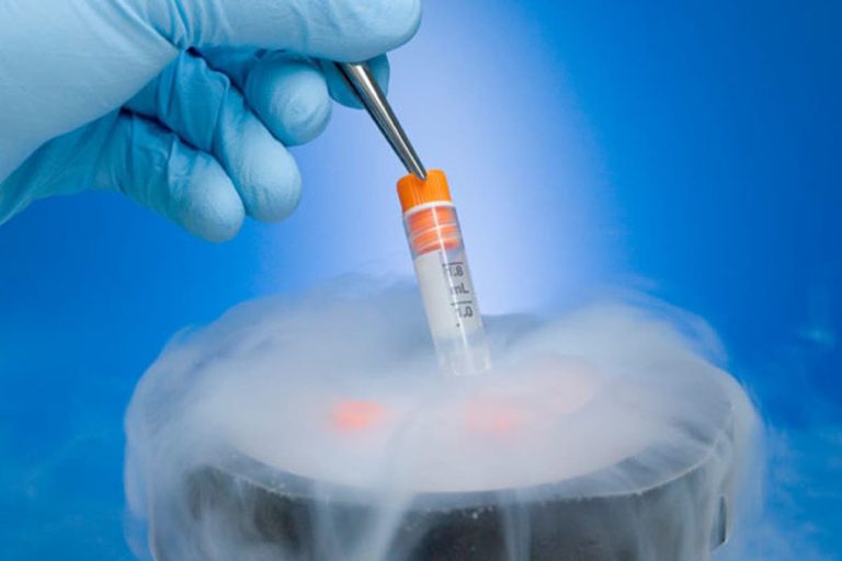 Rabat.. A medical laboratory succeeds in the first ovary freezing operation in Morocco