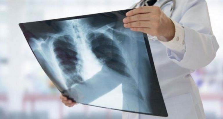 The Ministry of Health and Social Protection Commemorates International Day to combat tuberculosis