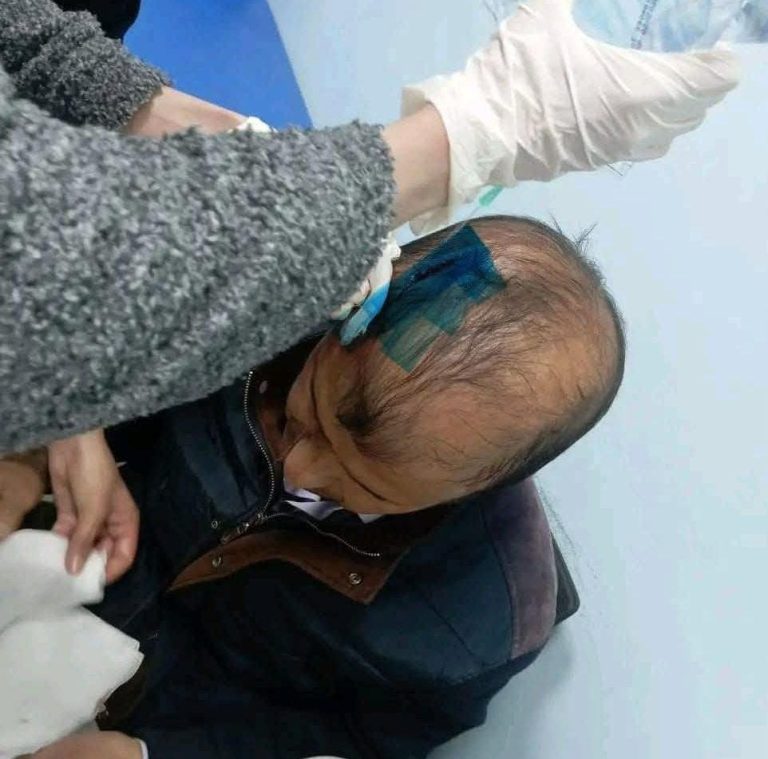 Khenifra .. a student assaulting a secondary director and sending him to a serious condition to the hospital