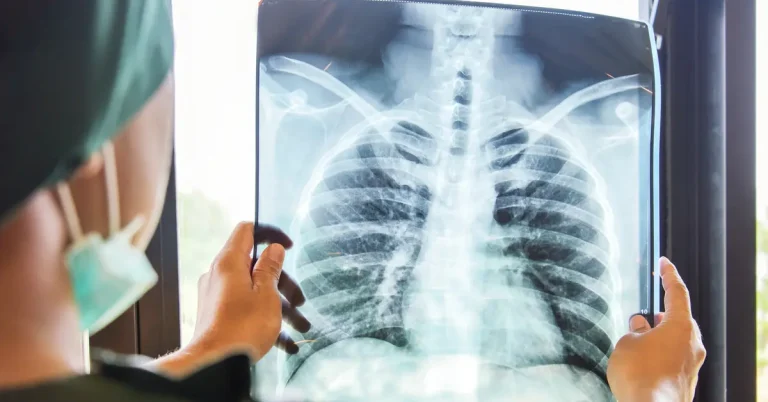 The Tengher health delegate confirms: "The position of tuberculosis in the region is under control."