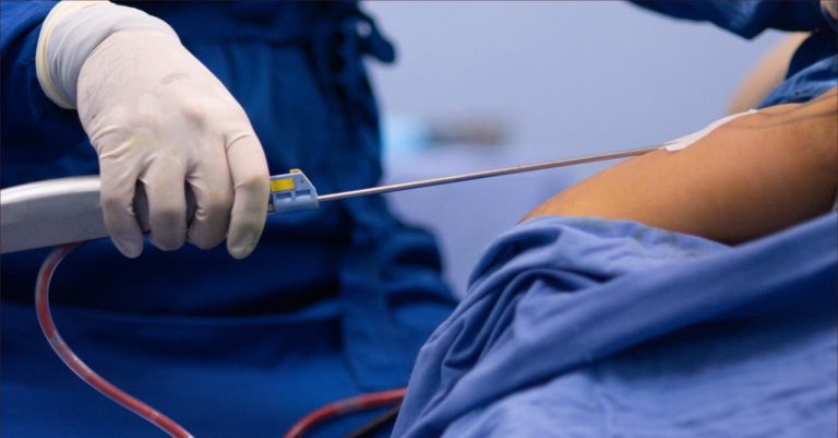 The death of a fashion designer in Tangier after a failed liposuction