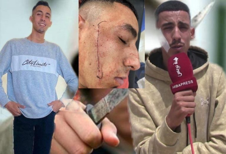 The young "Nizar" is the victim of "Tashamil" .. of a quiet life to a continuous suffering (video)