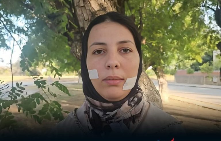 Two and a half years in prison for the accused by distorting Khadija's face